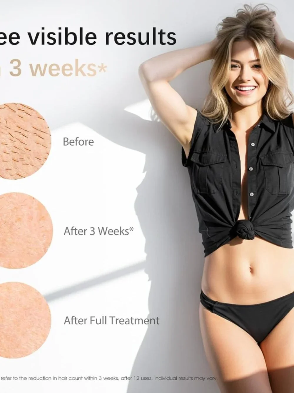 NEW IPL Laser Hair Removal Device for light/medium skin tones with dark hair